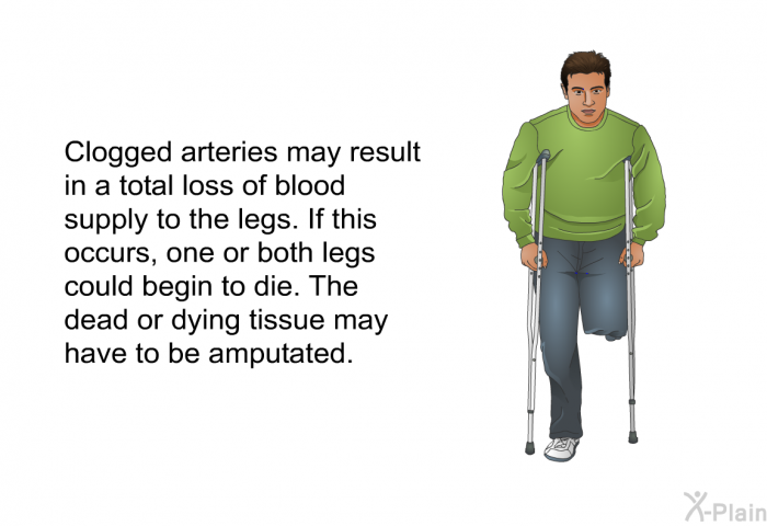 Clogged arteries may result in a total loss of blood supply to the legs. If this occurs, one or both legs could begin to die. The dead or dying tissue may have to be amputated.