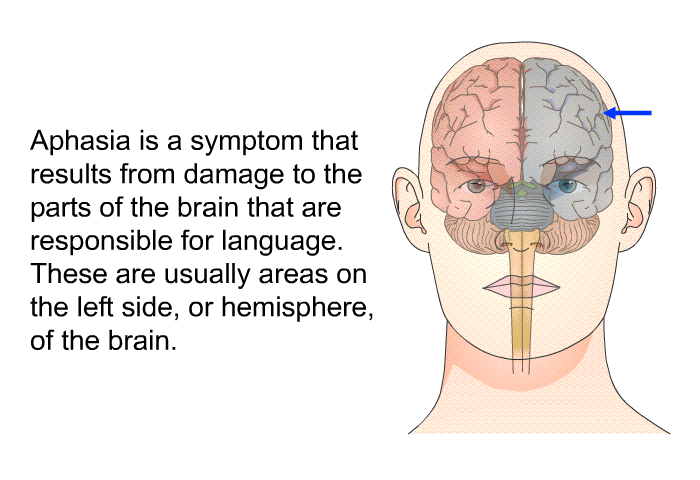 Aphasia is a symptom that results from damage to the parts of the brain that are responsible for language. These are usually areas on the left side, or hemisphere, of the brain.
