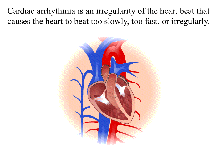 Cardiac arrhythmia is an irregularity of the heart beat that causes the heart to beat too slowly, too fast, or irregularly.