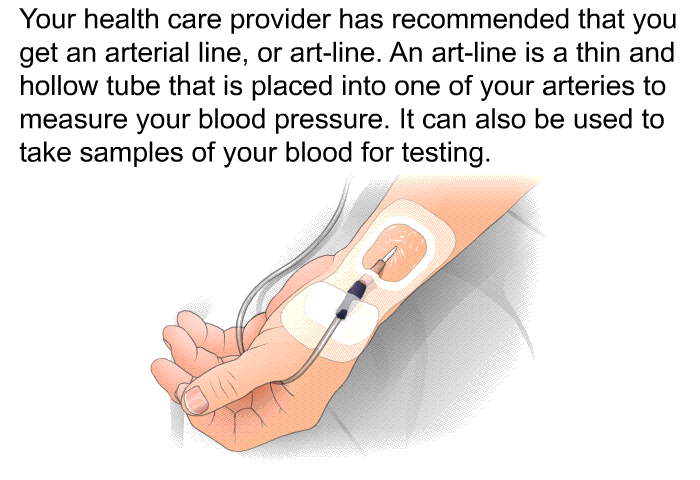 Your health care provider has recommended that you get an arterial line, or art-line. An art-line is a thin and hollow tube that is placed into one of your arteries to measure your blood pressure. It can also be used to take samples of your blood for testing.