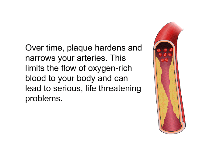 Over time, plaque hardens and narrows your arteries. This limits the flow of oxygen-rich blood to your body and can lead to serious, life threatening problems.