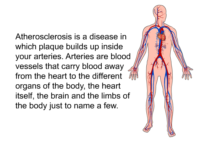 Atherosclerosis is a disease in which plaque builds up inside your arteries. Arteries are blood vessels that carry blood away from the heart to the different organs of the body, the heart itself, the brain and the limbs of the body just to name a few.