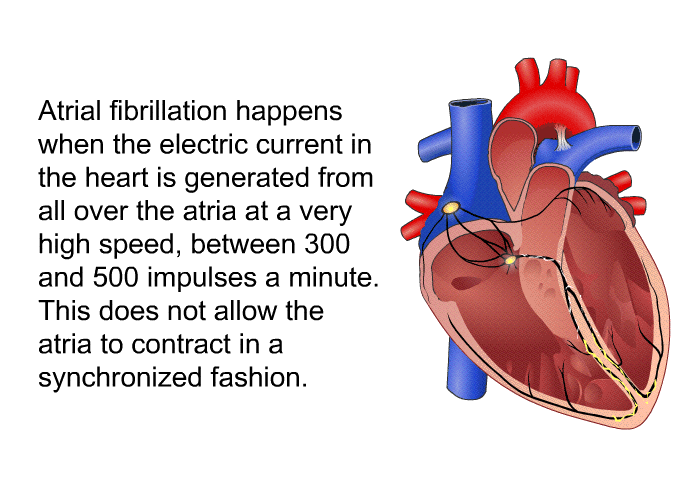 Atrial fibrillation happens when the electric current in the heart is generated from all over the atria at a very high speed, between 300 and 500 impulses a minute. This does not allow the atria to contract in a synchronized fashion.
