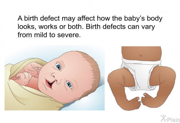 A birth defect may affect how the baby's body looks, works or both. Birth defects can vary from mild to severe.