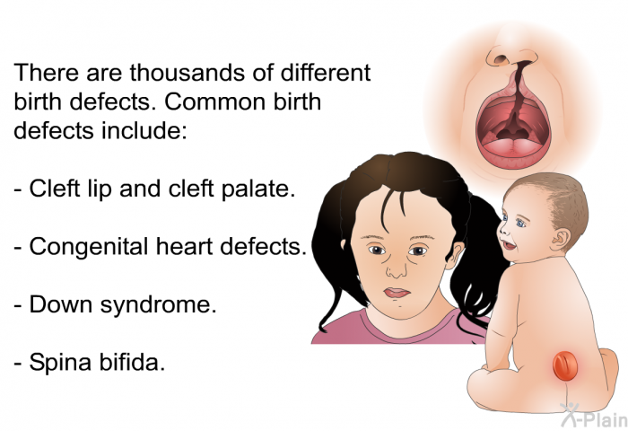 There are thousands of different birth defects. Common birth defects include:  Cleft lip and cleft palate. Congenital heart defects. Down syndrome. Spina bifida.