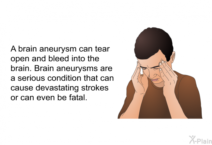 A brain aneurysm can tear open and bleed into the brain. Brain aneurysms are a serious condition that can cause devastating strokes or can even be fatal.