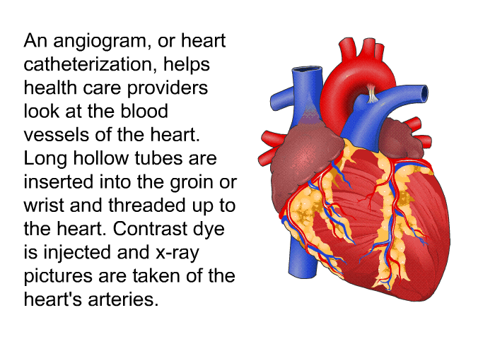 An angiogram, or heart catheterization, helps health care providers look at the blood vessels of the heart. Long hollow tubes are inserted into the groin or wrist and threaded up to the heart. Contrast dye is injected and x-ray pictures are taken of the heart's arteries.