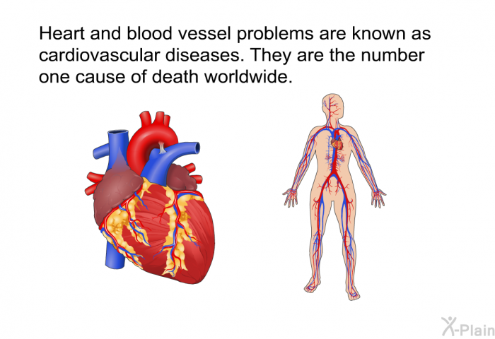 Heart and blood vessel problems are known as cardiovascular diseases. They are the number one cause of death worldwide.