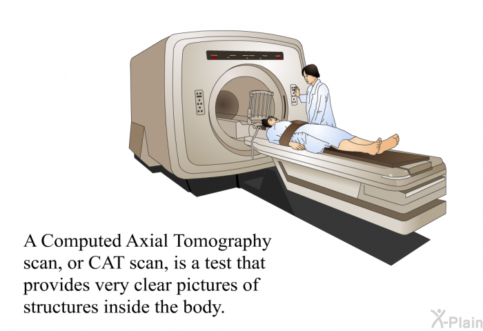 A Computed Axial Tomography scan, or CAT scan, is a test that provides very clear pictures of structures inside the body.