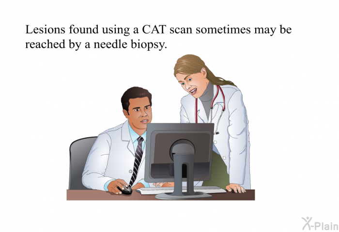 Lesions found using a CAT scan sometimes may be reached by a needle biopsy.