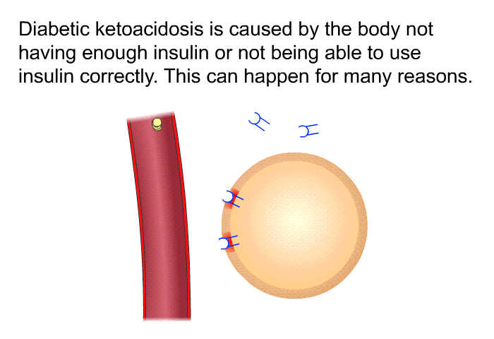 Diabetic ketoacidosis is caused by the body not having enough insulin or not being able to use insulin correctly. This can happen for many reasons.