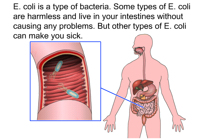 E. coli is a type of bacteria. Some types of E. coli are harmless and live in your intestines without causing any problems. But other types of E. coli can make you sick.