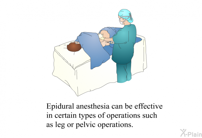 Epidural anesthesia can be effective in certain types of operations such as leg or pelvic operations.