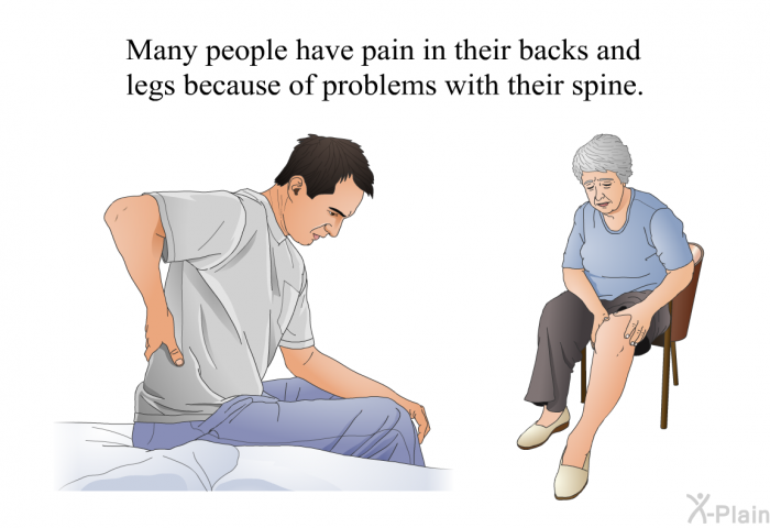 Many people have pain in their backs and legs because of problems with their spine.