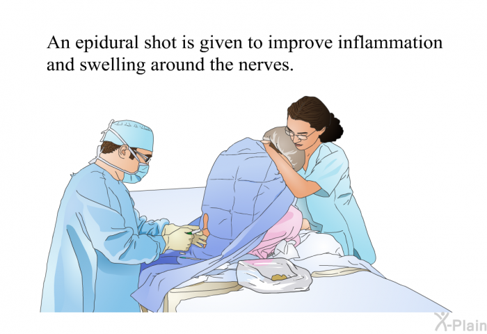 An epidural shot is given to improve inflammation and swelling around the nerves.