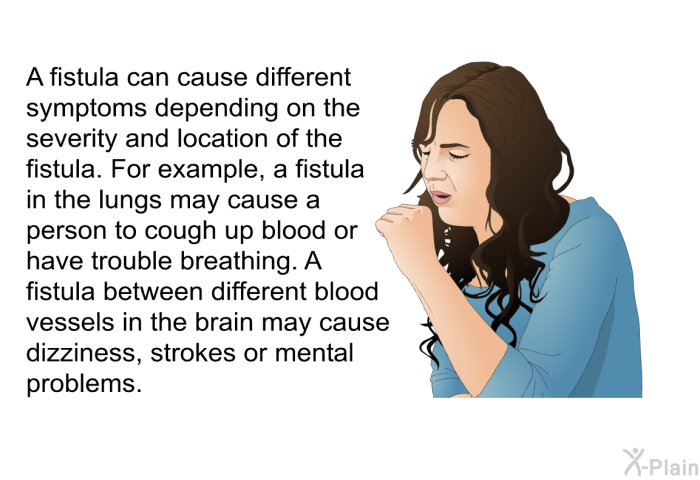 A fistula can cause different symptoms depending on the severity and location of the fistula. For example, a fistula in the lungs may cause a person to cough up blood or have trouble breathing. A fistula between different blood vessels in the brain may cause dizziness, strokes or mental problems.