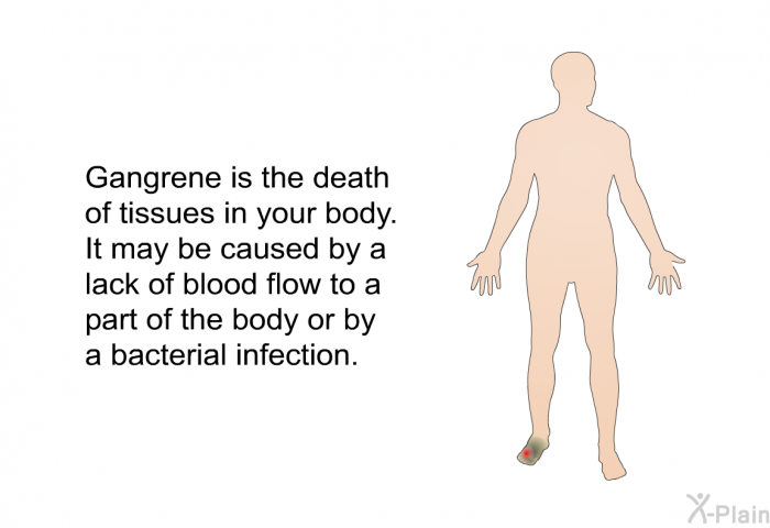 Gangrene is the death of tissues in your body. It may be caused by a lack of blood flow to a part of the body or by a bacterial infection.