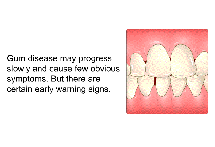 Gum disease may progress slowly and cause few obvious symptoms. But there are certain early warning signs.