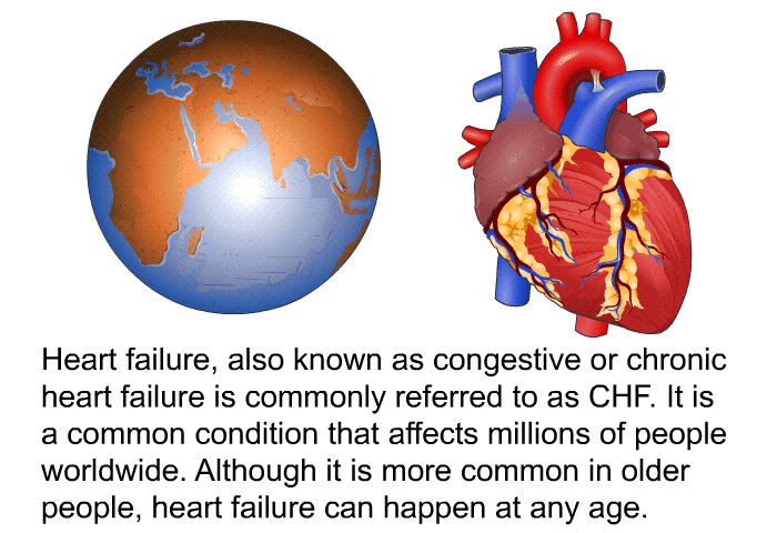 Heart failure, also known as congestive or chronic heart failure is commonly referred to as CHF. It is a common condition that affects millions of people worldwide. Although it is more common in older people, heart failure can happen at any age.