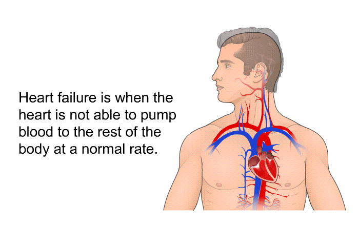 Heart failure is when the heart is not able to pump blood to the rest of the body at a normal rate.