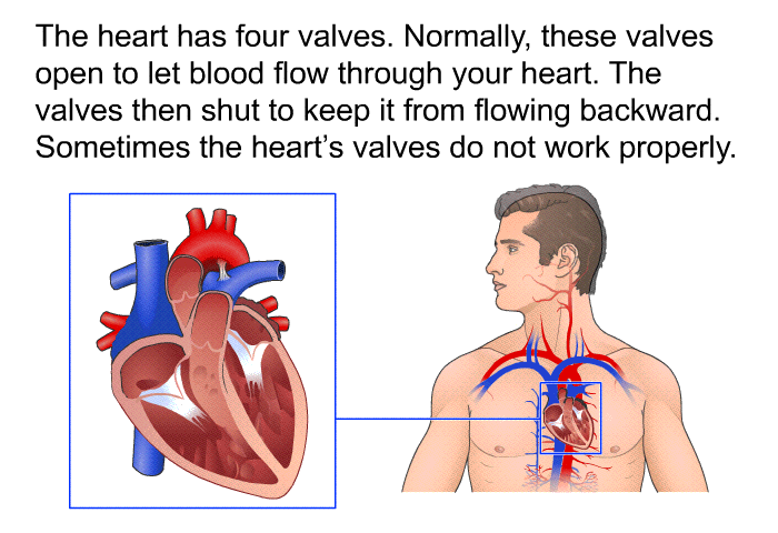 The heart has four valves. Normally, these valves open to let blood flow through your heart. The valves then shut to keep it from flowing backward. Sometimes the heart's valves do not work properly.