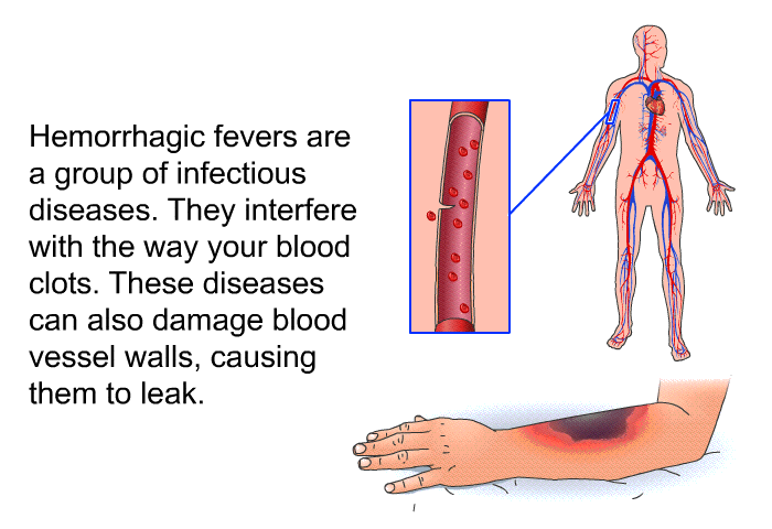Hemorrhagic fevers are a group of infectious diseases. They interfere with the way your blood clots. These diseases can also damage blood vessel walls, causing them to leak.