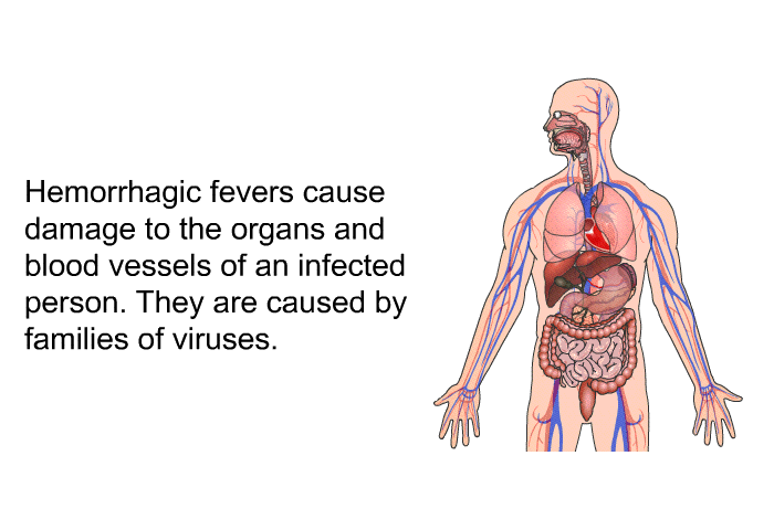 Hemorrhagic fevers cause damage to the organs and blood vessels of an infected person. They are caused by families of viruses.