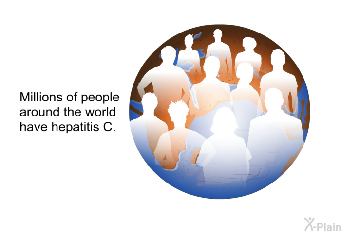 Millions of people around the world have hepatitis C.