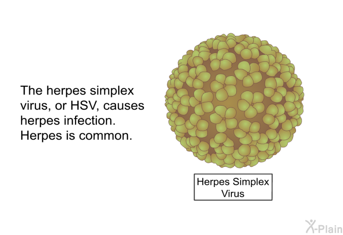 The herpes simplex virus, or HSV, causes herpes infection. Herpes is common.