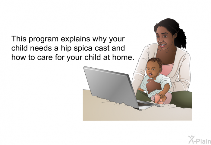 This health information explains why your child needs a hip spica cast and how to care for your child at home.