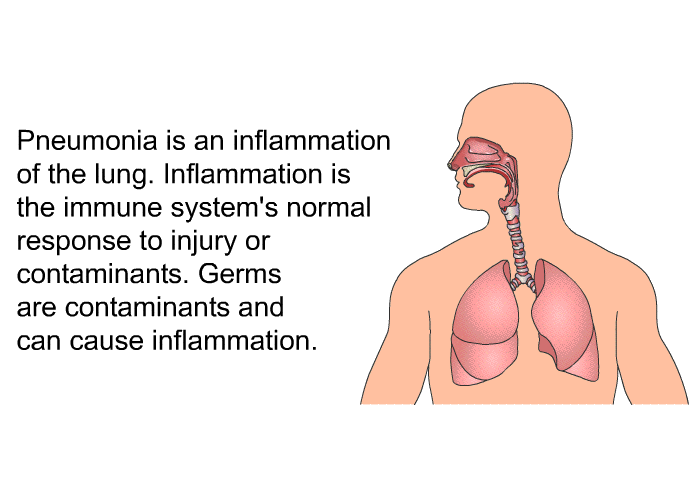 Pneumonia is an inflammation of the lung. Inflammation is the immune system's normal response to injury or contaminants. Germs are contaminants and can cause inflammation.