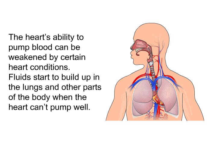 The heart's ability to pump blood can be weakened by certain heart conditions. Fluids start to build up in the lungs and other parts of the body when the heart can't pump well.