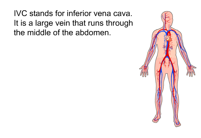 IVC stands for inferior vena cava. It is a large vein that runs through the middle of the abdomen.