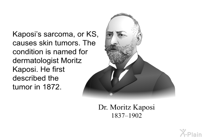Kaposi's sarcoma, or KS, causes skin tumors. The condition is named for dermatologist Moritz Kaposi. He first described the tumor in 1872.