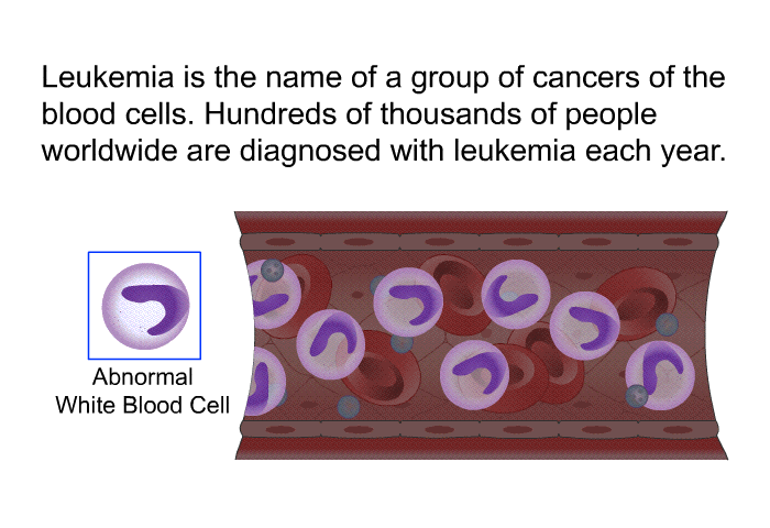 Leukemia is the name of a group of cancers of the blood cells. Hundreds of thousands of people worldwide are diagnosed with leukemia each year.