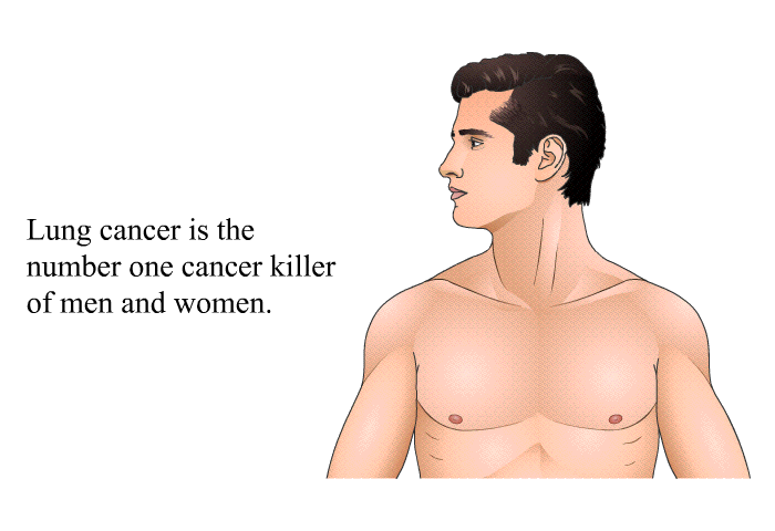Lung cancer is the number one cancer killer of men and women.