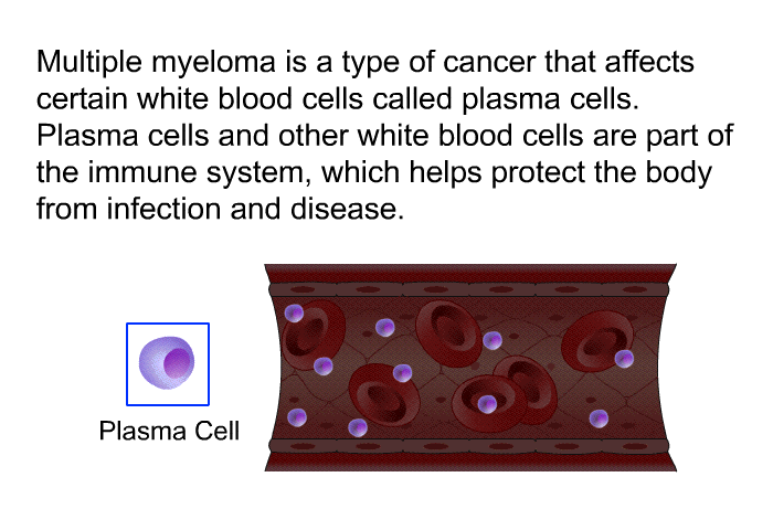 Multiple myeloma is a type of cancer that affects certain white blood cells called plasma cells. Plasma cells and other white blood cells are part of the immune system, which helps protect the body from infection and disease.
