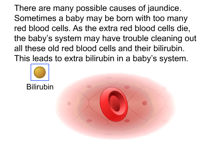 There are many possible causes of jaundice. Sometimes a baby may be born with too many red blood cells. As the extra red blood cells die, the baby's system may have trouble cleaning out all these old red blood cells and their bilirubin. This leads to extra bilirubin in a baby's system.