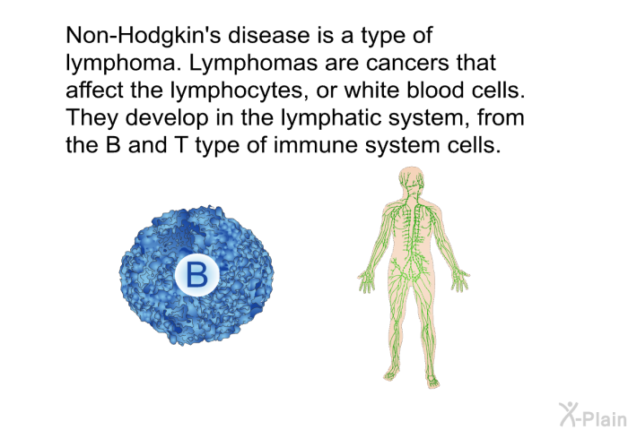 Non-Hodgkin's disease is a type of lymphoma. Lymphomas are cancers that affect the lymphocytes, or white blood cells. They develop in the lymphatic system, from the B and T type of immune system cells.