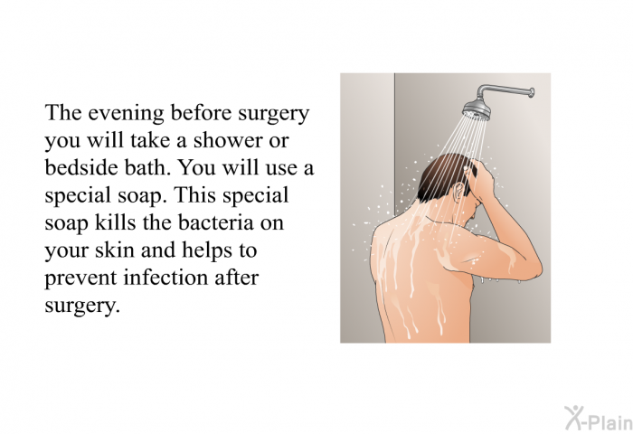 The evening before surgery you will take a shower or bedside bath. You will use a special soap. This special soap kills the bacteria on your skin and helps to prevent infection after surgery.