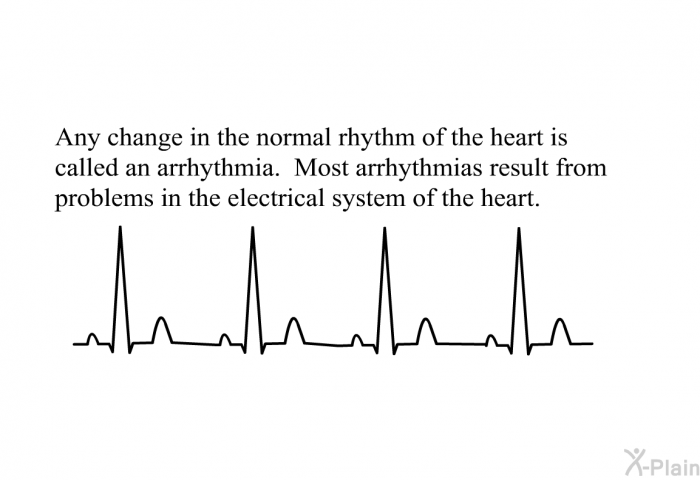 Any change in the normal rhythm of the heart is called an arrhythmia. Most arrhythmias result from problems in the electrical system of the heart.