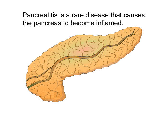 Pancreatitis is a rare disease that causes the pancreas to become inflamed.