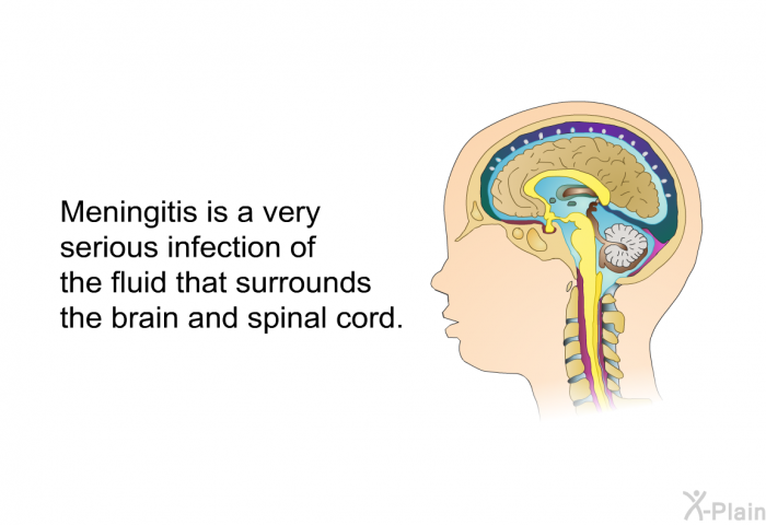 Meningitis is a very serious infection of the fluid that surrounds the brain and spinal cord.