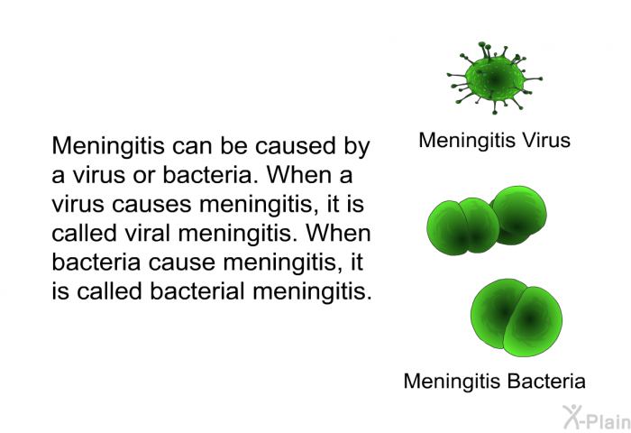 Meningitis can be caused by a virus or bacteria. When a virus causes meningitis, it is called viral meningitis. When bacteria cause meningitis, it is called bacterial meningitis.
