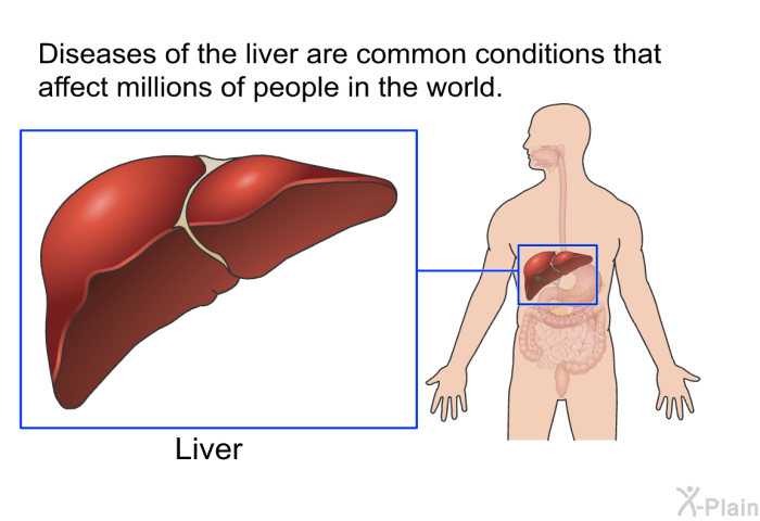 Diseases of the liver are common conditions that affect millions of people in the world.