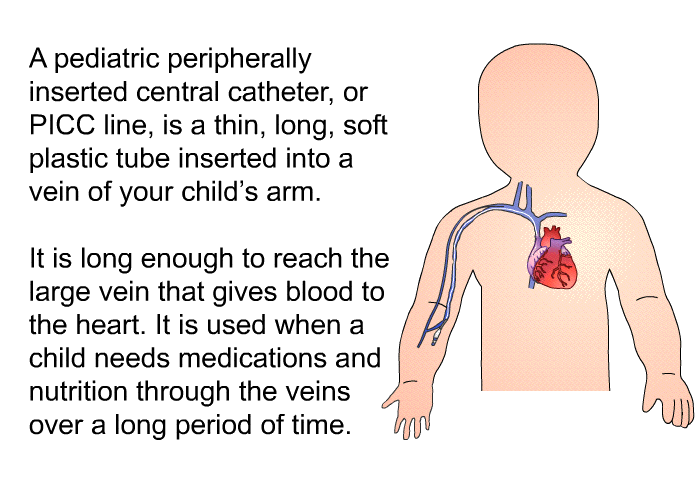 A pediatric peripherally inserted central catheter, or PICC line, is a thin, long, soft plastic tube inserted into a vein of your child's arm. It is long enough to reach the large vein that gives blood to the heart. It is used when a child needs medications and nutrition through the veins over a long period of time.