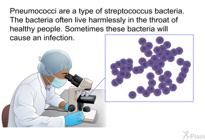 Pneumococci are a type of streptococcus bacteria. The bacteria often live harmlessly in the throat of healthy people. Sometimes these bacteria will cause an infection.