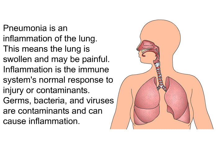 Pneumonia is an inflammation of the lung. This means the lung is swollen and may be painful. Inflammation is the immune system's normal response to injury or contaminants. Germs, bacteria, and viruses are contaminants and can cause inflammation.