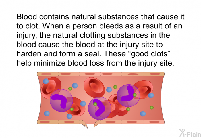 Blood contains natural substances that cause it to clot. When a person bleeds as a result of an injury, the natural clotting substances in the blood cause the blood at the injury site to harden and form a seal. These “good clots” help minimize blood loss from the injury site.