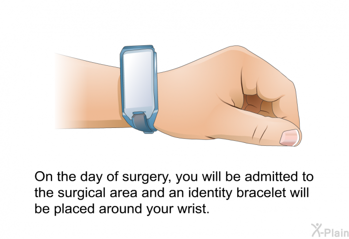 On the day of surgery, you will be admitted to the surgical area and an identity bracelet will be placed around your wrist.